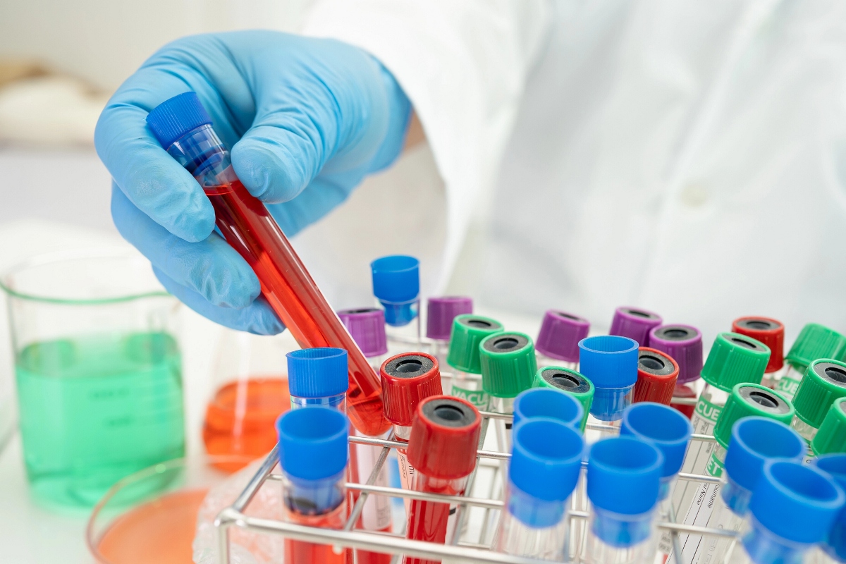 Analisi del sangue, Laboratorio San Giuseppe Zola Predosa